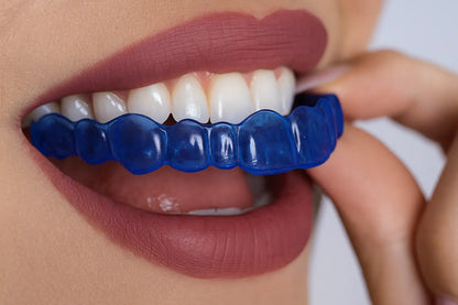 NightShield Dental - Mouldable blue nightguard