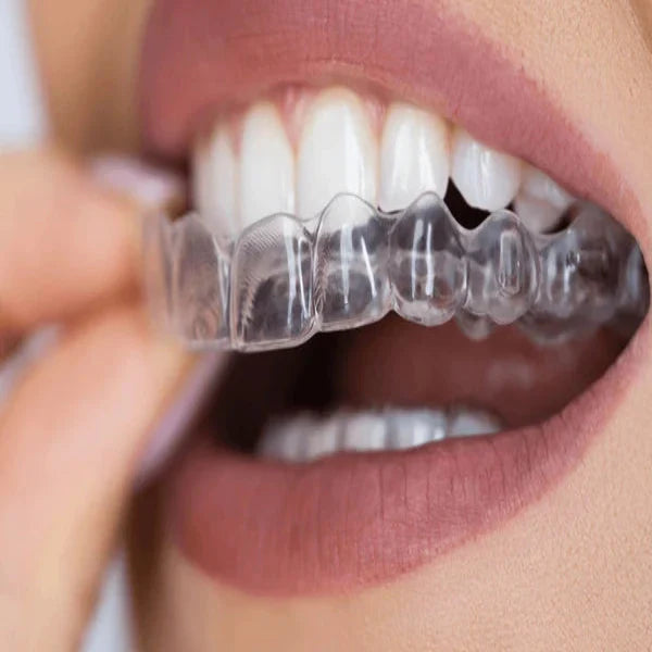 Clear NightShield Dental Mouldable Nightguard being worn in a mouth with a neutral background